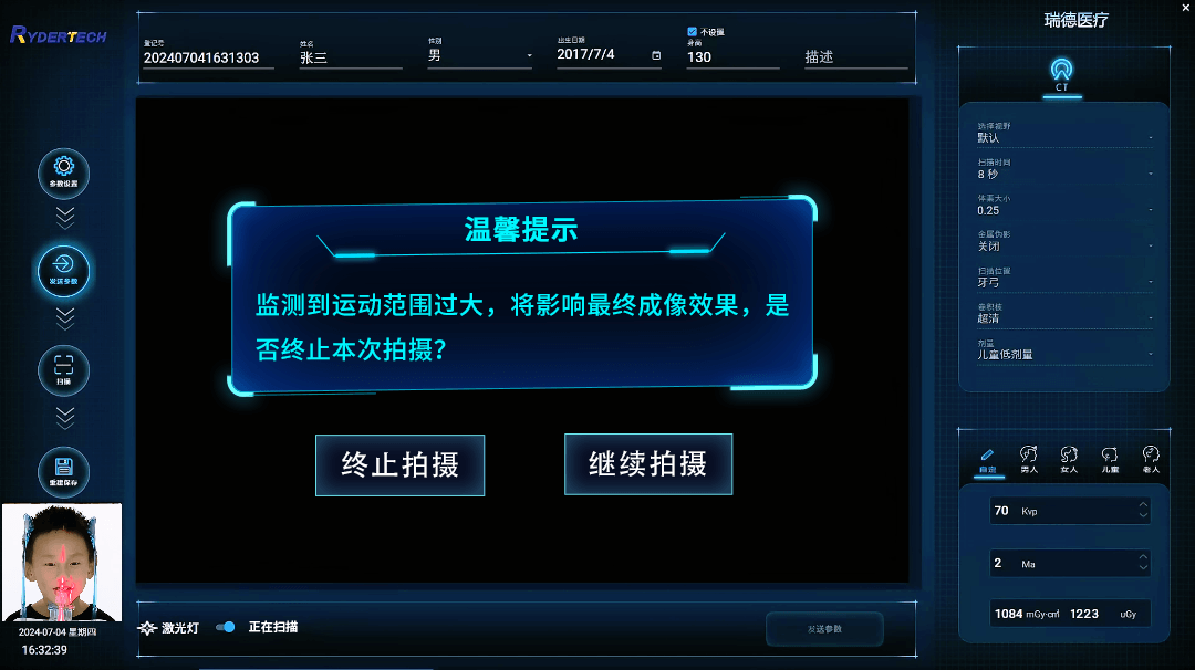 防运动监测系统，如运动范围过大，提示停止曝光