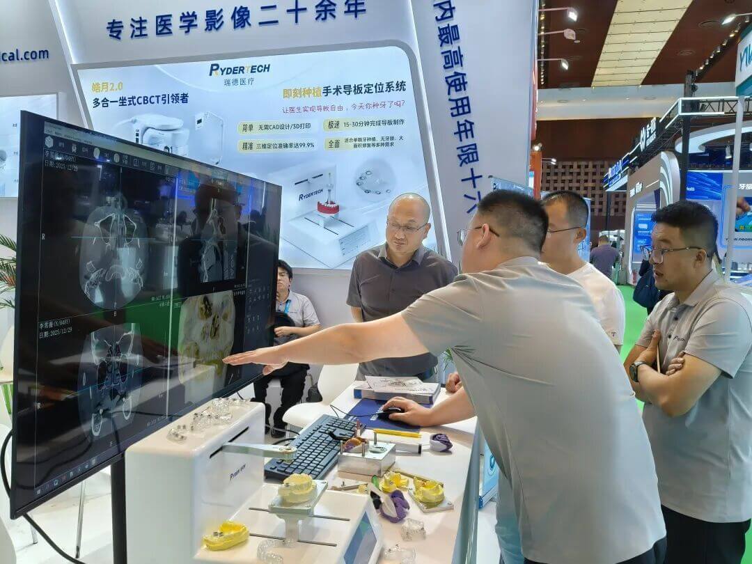 南京瑞德医疗即刻种植手术导板定位系统 南京瑞德医疗即刻种植手术导板定位系统